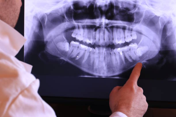 Best Emergency Tooth Extraction in Crooks, SD